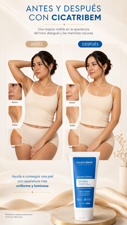 CICATRIBEM CREMA ACLARANTE
